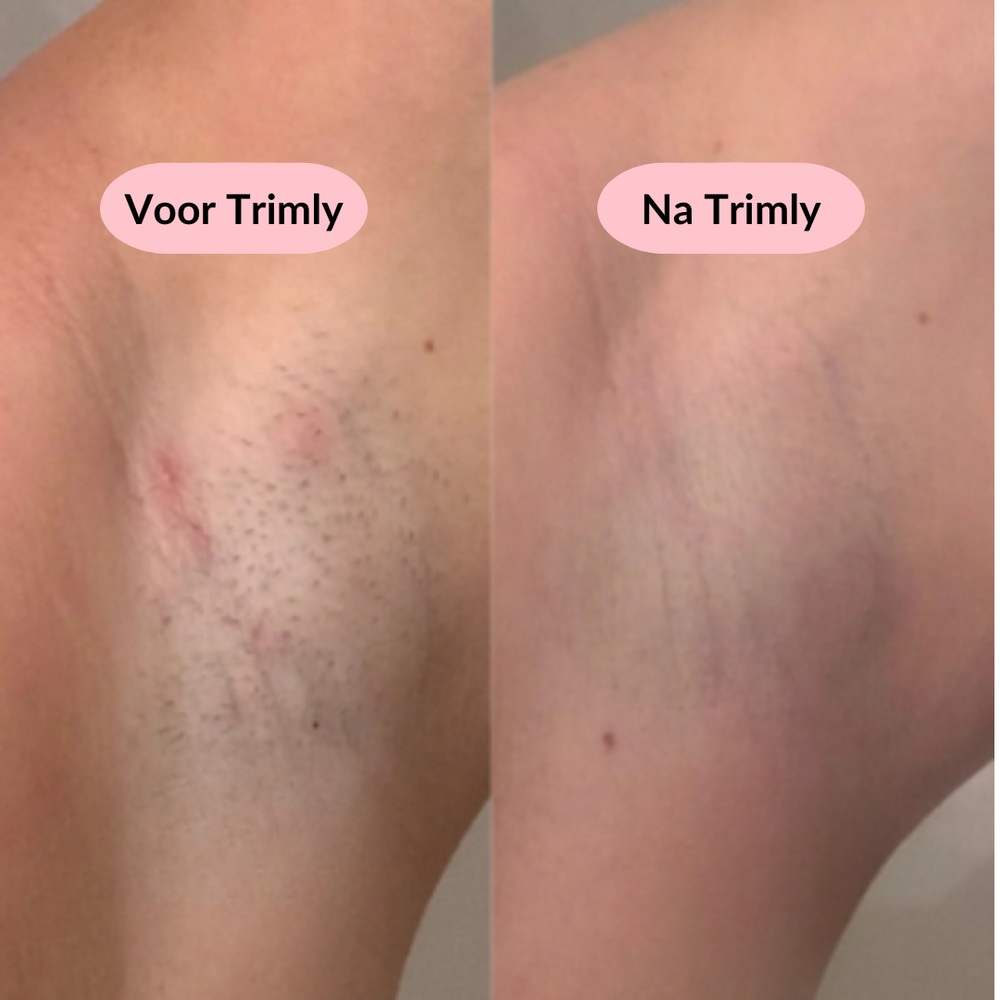 Lady Scheerapparaat 2-in-1 – Zijdezacht, pijnloos & snel