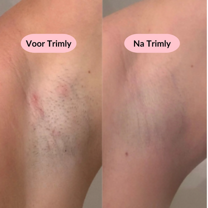 Lady Scheerapparaat 2-in-1 – Zijdezacht, pijnloos & snel